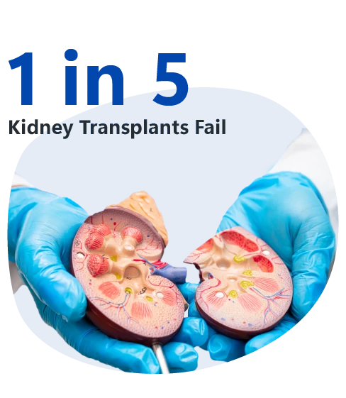 Kidney transplant illustration